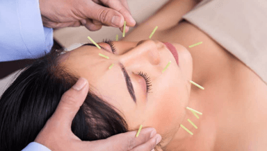 Image for Cosmetic Acupuncture
